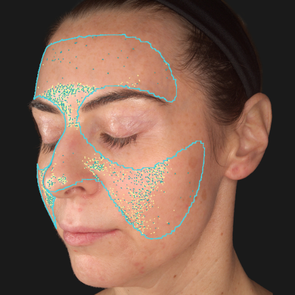 Advanced Skin Analysis - Texture