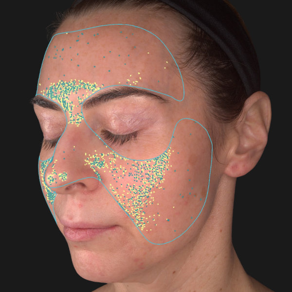 Advanced Skin Analysis - Texture